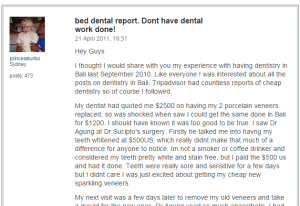 Review of porcelain veneers