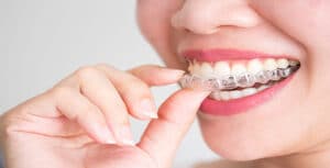 A better smile with Invisalign | Redlands Gentle Dental care